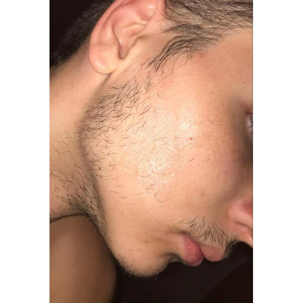 Minoxidil Rogaine 5%, 1 Luna Aplicare, Tratament Pentru Barba / Scalp