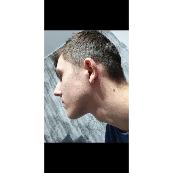 Minoxidil Dualgen 5% - Absorbtie Rapida, fara PG, 1 lună aplicare, Tratament Pentru Barba / Scalp