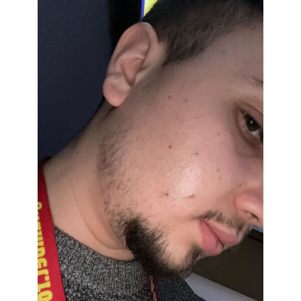 Minoxidil Foligain 5%, 3 Luni Aplicare +Dermaroller, Tratament Pentru Barba / Scalp