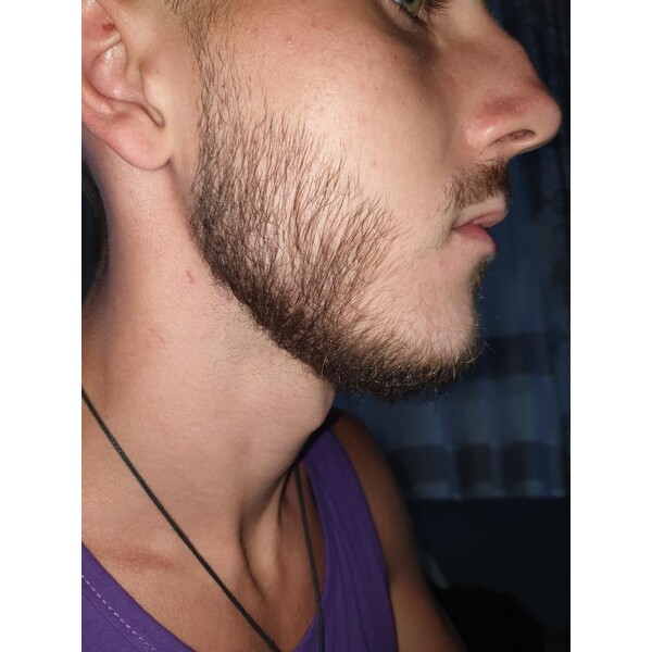 Minoxidil Dualgen 5% - Absorbtie Rapida, fara PG, 1 lună aplicare, Tratament Pentru Barba / Scalp