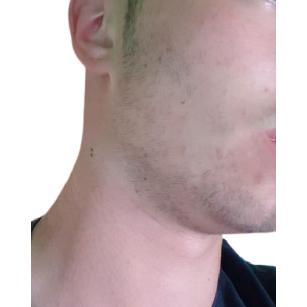 Minoxidil Dualgen 10%, 1 Luna Aplicare, Tratament Pentru Barba / Scalp