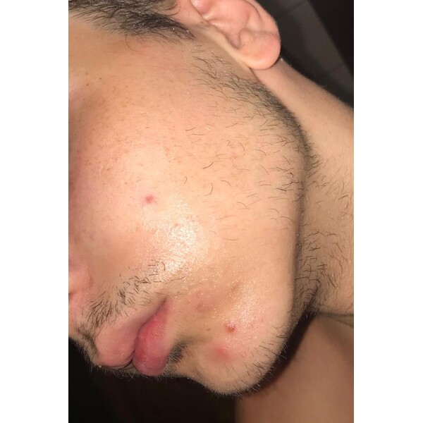 Minoxidil Rogaine 5%, 1 Luna Aplicare, Tratament Pentru Barba / Scalp