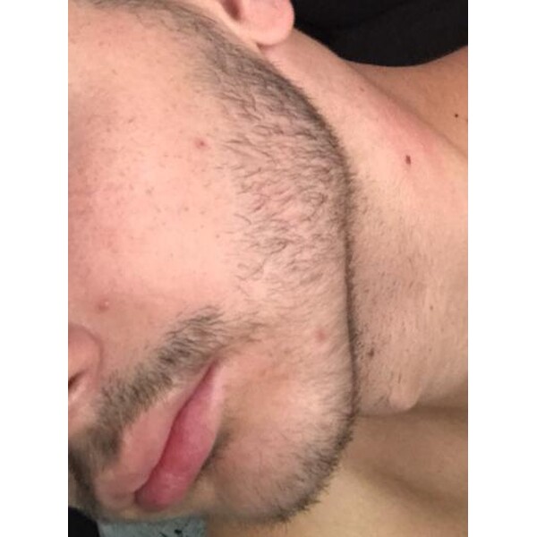 Minoxidil Rogaine 5%, 1 Luna Aplicare, Tratament Pentru Barba / Scalp