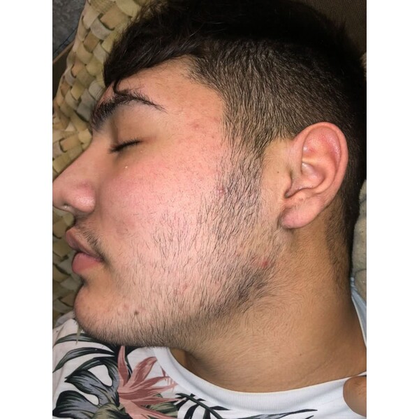 Minoxidil Kirkland 5%, 1 Luna Aplicare, Tratament Pentru Barba / Scalp