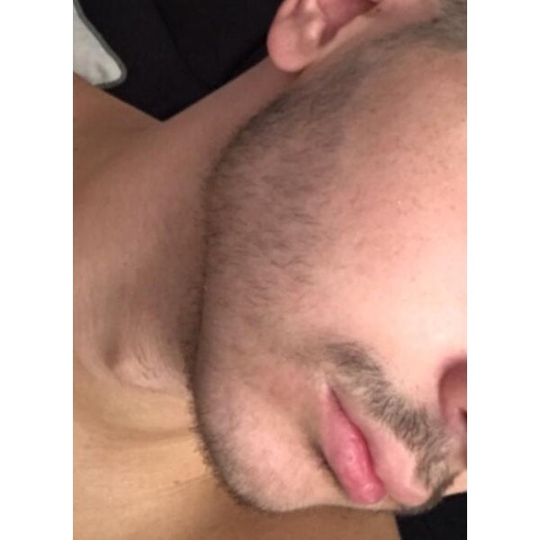 Minoxidil Rogaine 5%, 1 Luna Aplicare, Tratament Pentru Barba / Scalp