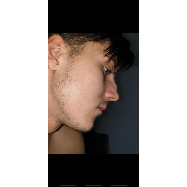 Minoxidil Dualgen 5% - Absorbtie Rapida, fara PG, 1 lună aplicare, Tratament Pentru Barba / Scalp