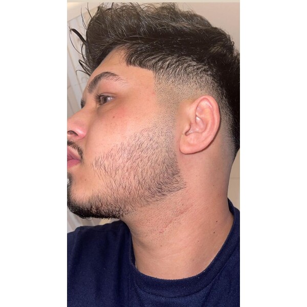 Minoxidil EssenGen 5% - Absorbtie Rapida, fara PG, 1-2 luni aplicare, Tratament Pentru Barba / Scalp, Unisex