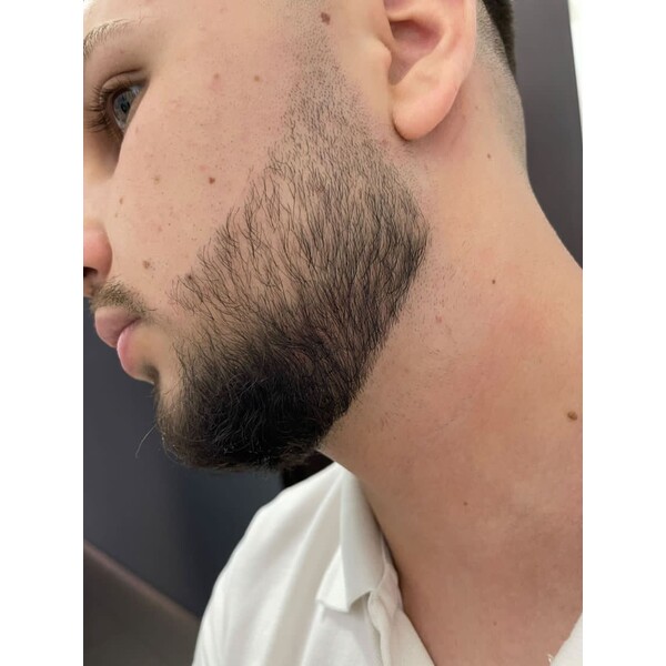 Minoxidil Foligain 5%, 3 Luni Aplicare +Dermaroller, Tratament Pentru Barba / Scalp