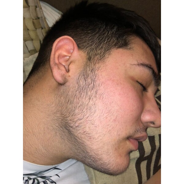 Minoxidil Kirkland 5%, 1 Luna Aplicare, Tratament Pentru Barba / Scalp