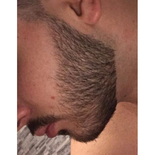 Minoxidil Rogaine 5%, 1 Luna Aplicare, Tratament Pentru Barba / Scalp