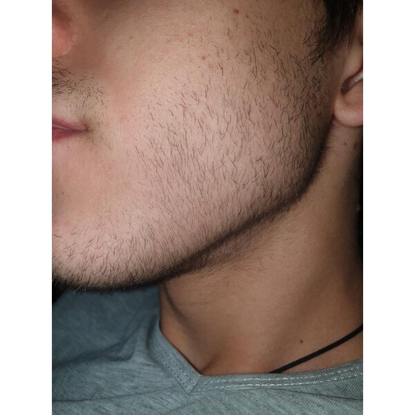 Minoxidil Dualgen 5% - Absorbtie Rapida, fara PG, 1 lună aplicare, Tratament Pentru Barba / Scalp