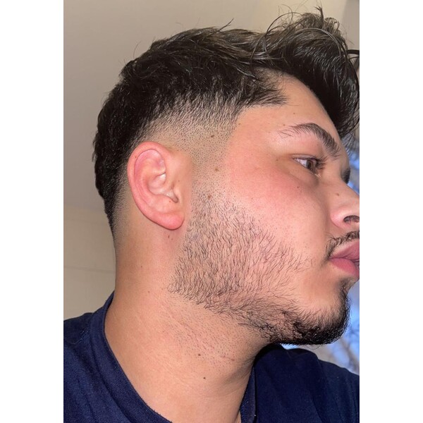 Minoxidil EssenGen 5% - Absorbtie Rapida, fara PG, 1-2 luni aplicare, Tratament Pentru Barba / Scalp, Unisex