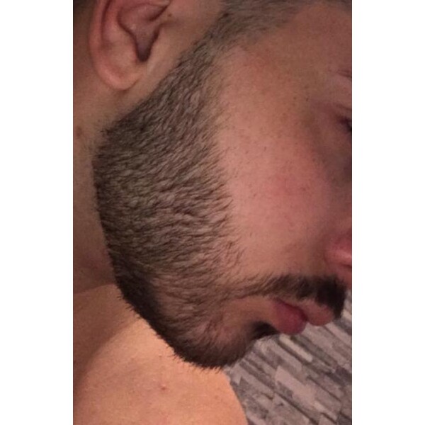 Minoxidil Rogaine 5%, 1 Luna Aplicare, Tratament Pentru Barba / Scalp