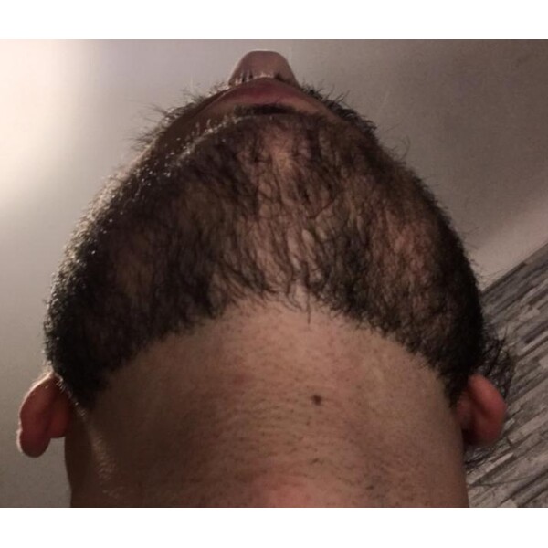 Minoxidil Rogaine 5%, 1 Luna Aplicare, Tratament Pentru Barba / Scalp