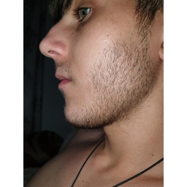 Minoxidil Dualgen 5% - Absorbtie Rapida, fara PG, 1 lună aplicare, Tratament Pentru Barba / Scalp