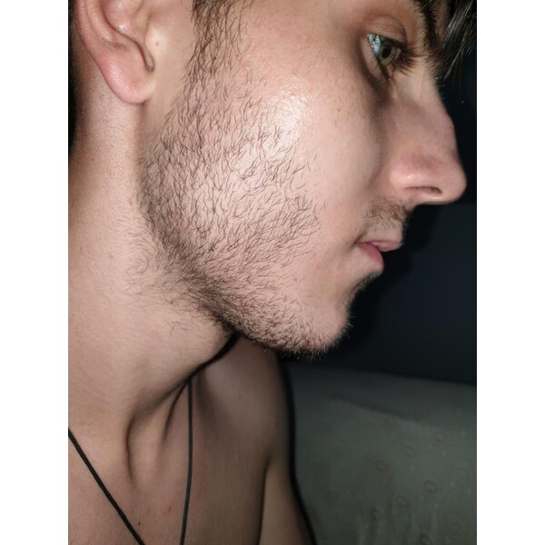 Minoxidil Dualgen 5% - Absorbtie Rapida, fara PG, 1 lună aplicare, Tratament Pentru Barba / Scalp