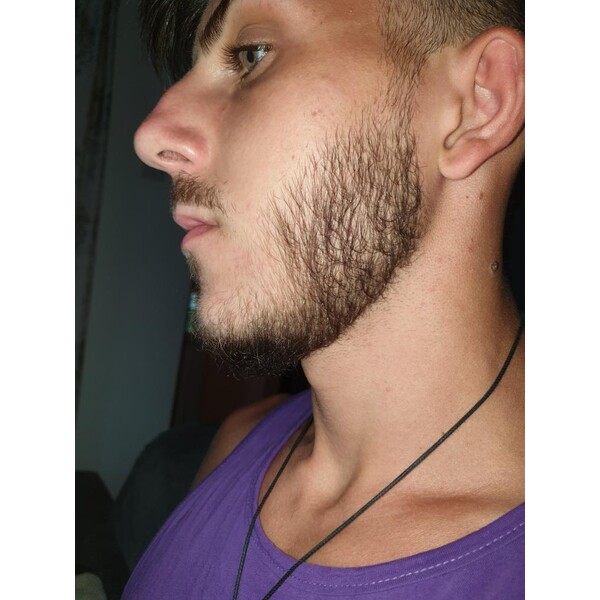 Minoxidil Dualgen 5% - Absorbtie Rapida, fara PG, 1 lună aplicare, Tratament Pentru Barba / Scalp