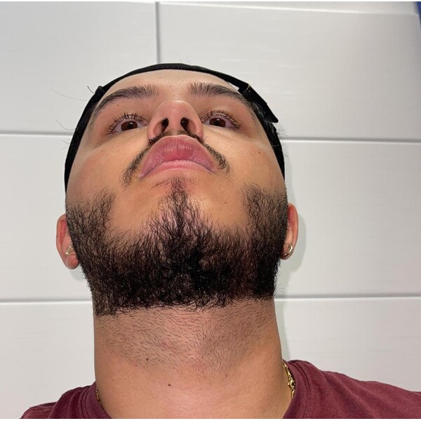 Minoxidil EssenGen 5% - Absorbtie Rapida, fara PG, 1-2 luni aplicare, Tratament Pentru Barba / Scalp, Unisex