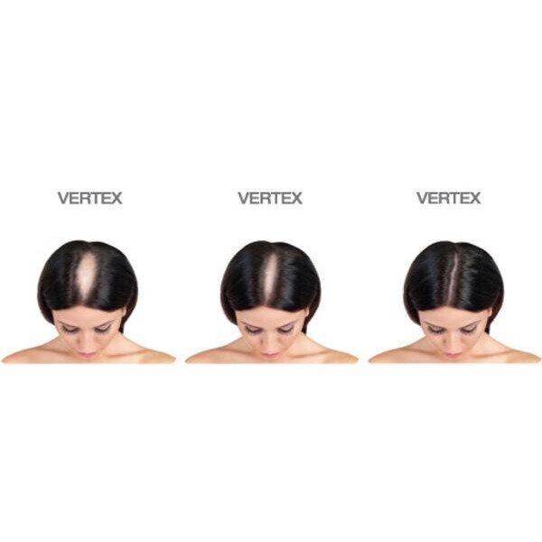 Minoxidil iiSolutions 2%, Pentru Femei, 1 Luna Aplicare, Now Biotin 5000 mcg, 60 capsule, Tratament Impotriva Caderii Parului La Femei