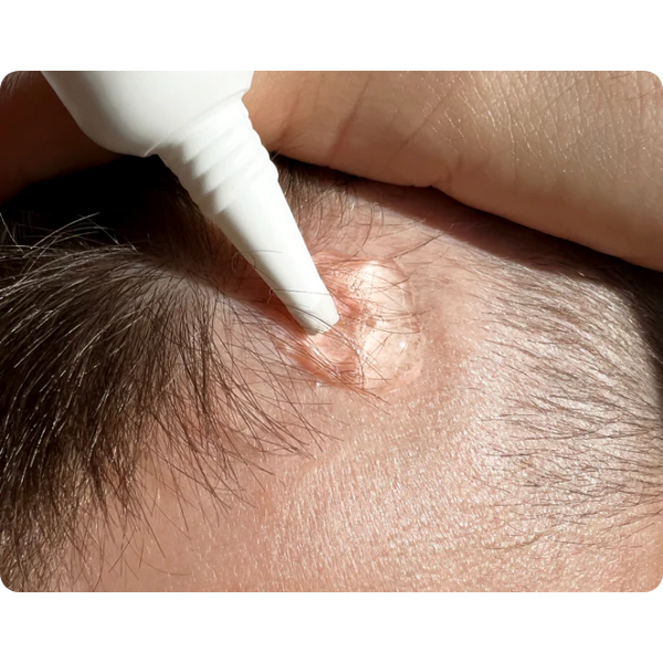 Copenhagen Grooming - Ser activator de creștere a părului,100 ml