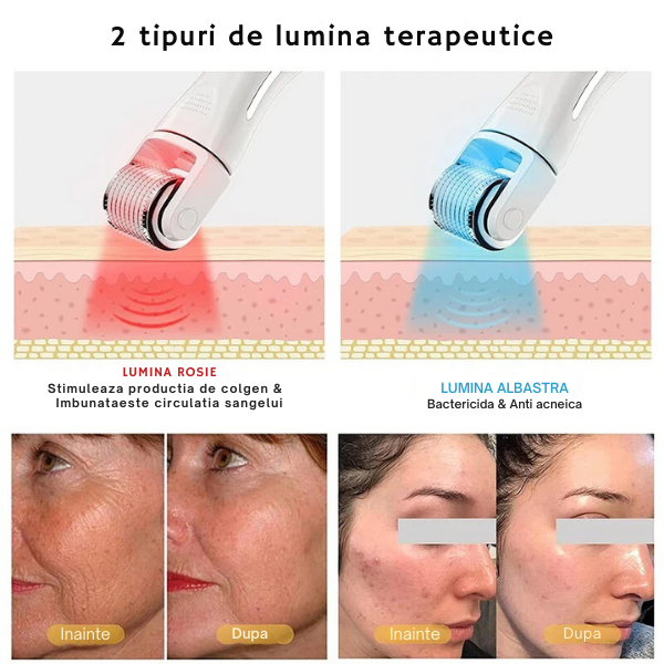 Dermaroller pentru mezoterapie cu lumina LED/pentru cresterea barbii si a parului, 540 ace, cu 3 capete inlocuibile