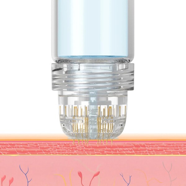 Dermaroller Hydra Needle 20, Aplicator de  ser cu micro ace Titan, Anti-îmbătrânire, Îngrijire față/păr și creșterea bărbii, Reutilizabil