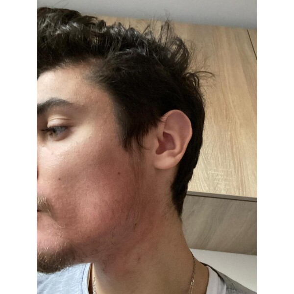 Minoxidil Foligain 5%, 1 Luna Aplicare, Tratament Pentru Barba/Scalp - Cantitate de Alcool redusa