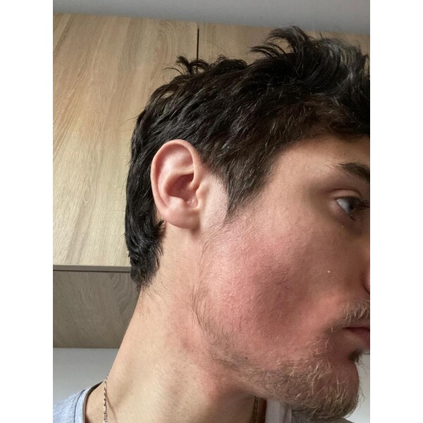 Minoxidil Foligain 5%, 1 Luna Aplicare, Tratament Pentru Barba/Scalp - Cantitate de Alcool redusa