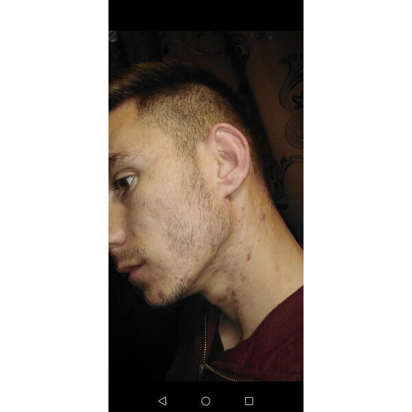 Spuma - Minoxidil Rogaine 5%, 1 Luna Aplicare, Tratament Pentru Barba / Scalp