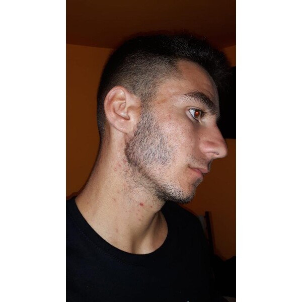 Spuma - Minoxidil Rogaine 5%, 1 Luna Aplicare, Tratament Pentru Barba / Scalp