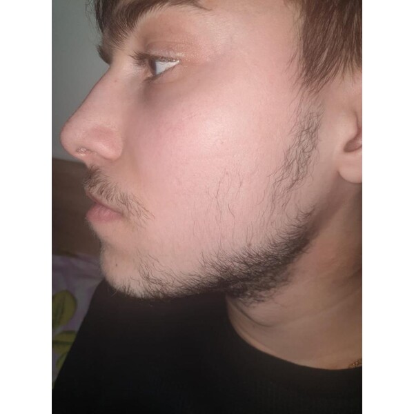 Minoxidil Foligain 5%, 1 Luna Aplicare, Tratament Pentru Barba/Scalp