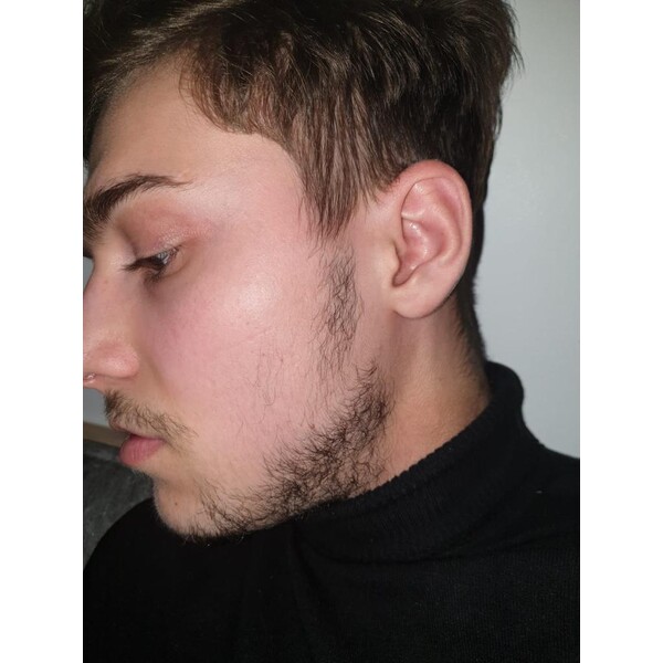 Minoxidil Foligain 5%, 1 Luna Aplicare, Tratament Pentru Barba/Scalp