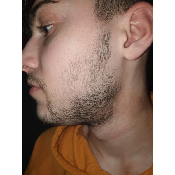 Minoxidil Foligain 5%, 1 Luna Aplicare, Tratament Pentru Barba/Scalp