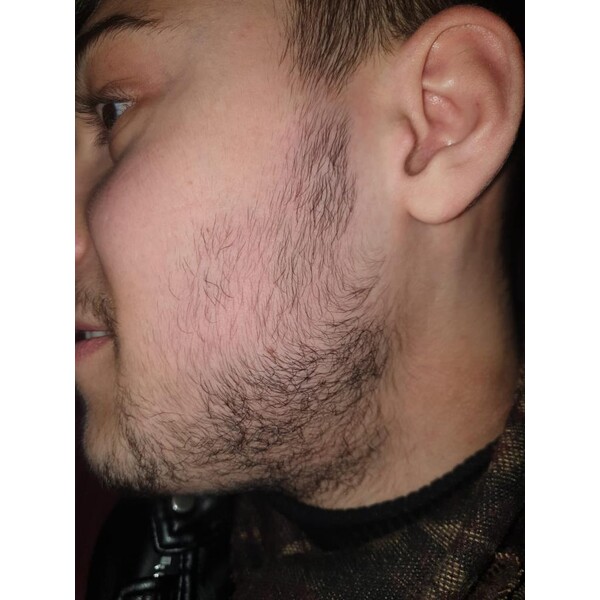 Minoxidil Foligain 5%, 1 Luna Aplicare, Tratament Pentru Barba/Scalp