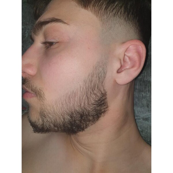 Minoxidil Foligain 5%, 1 Luna Aplicare, Tratament Pentru Barba/Scalp