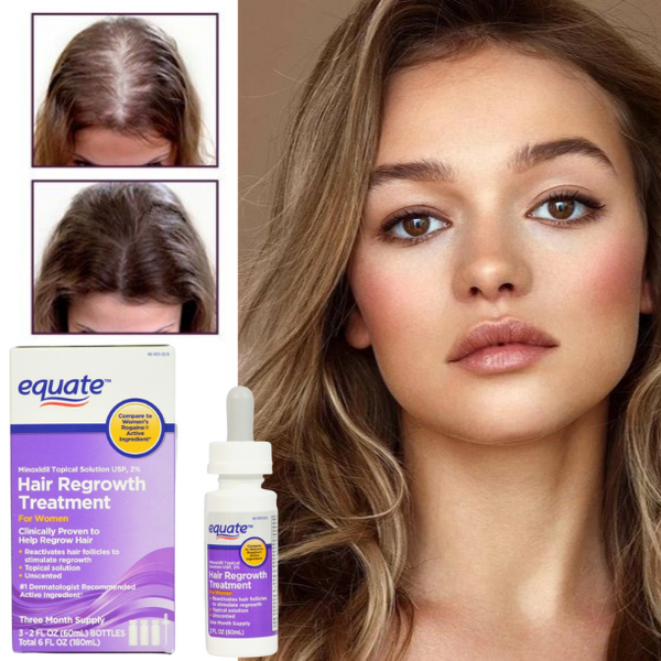 Minoxidil Equate 2% + Dermaroller, Pentru Femei, 1 Luna Aplicare, Tratament Impotriva Caderii Parului, Pipeta Inclusa