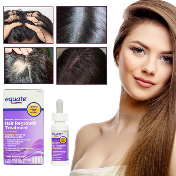 Minoxidil Equate 2% + Dermaroller, Pentru Femei, 1 Luna Aplicare, Tratament Impotriva Caderii Parului, Pipeta Inclusa